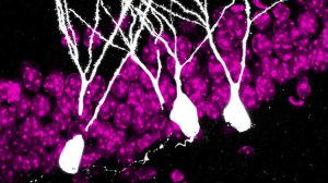 4 week-old neurons
