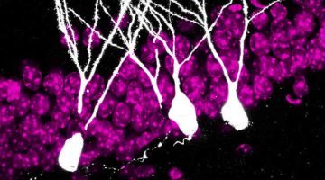 4 week-old neurons